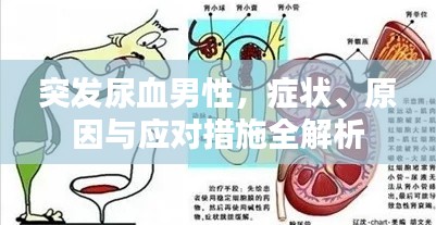 突发尿血男性,症状、原因与应对措施全解析