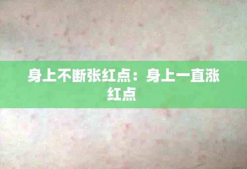 身上不断张红点:身上一直涨红点