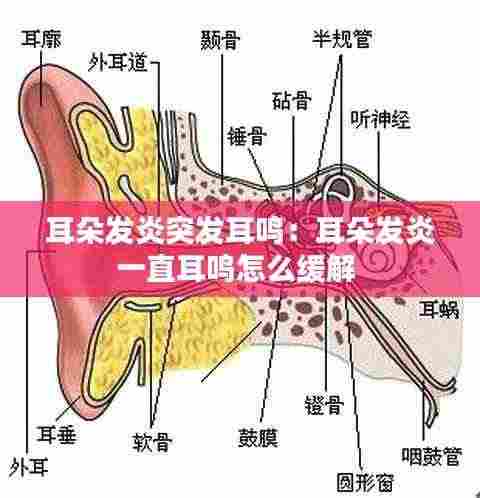 耳朵发炎突发耳鸣：耳朵发炎一直耳鸣怎么缓解 